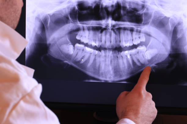 Best Emergency Gum Pain Relief  in Bullard, TX